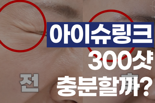 아이슈링크 300샷이면 충분할까? 효과 가르는 핵심 변수 3가지 썸네일