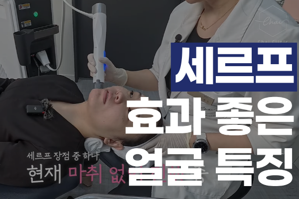 세르프 효과 좋은 얼굴 특징 썸네일