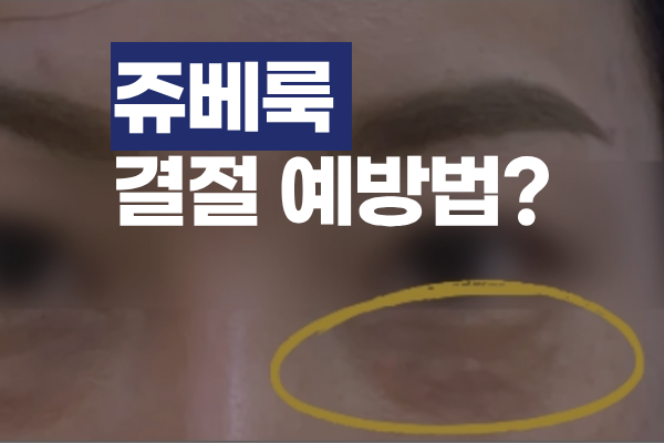 홍대 쥬베룩 결절 부작용 없이 안전하게 받는 방법 썸네일