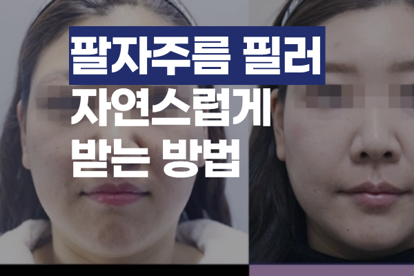 팔자주름 필러 과하지 않게, 자연스럽게 받는 방법 썸네일