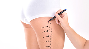 CHA.I Clinic Body Botox 项目