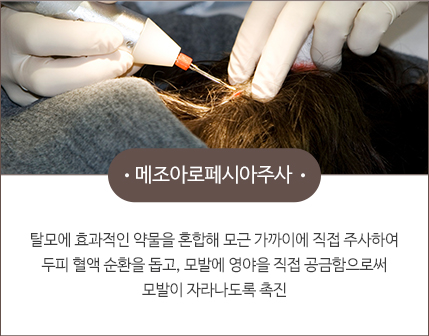CHA.I Clinic 脱发治疗